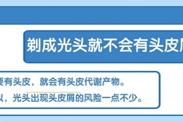 剃成光头就不会有头皮屑头皮健康应这样维护”